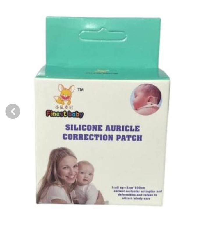 چسپ اصلاح گوش نوزاد